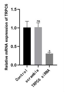 Transfection of WT9-12 cells with TRPC6 siRNA resulted in a change in the expression level of TRPC6. Values are means±SD (ns, not significant. *P<0.05, n=3).